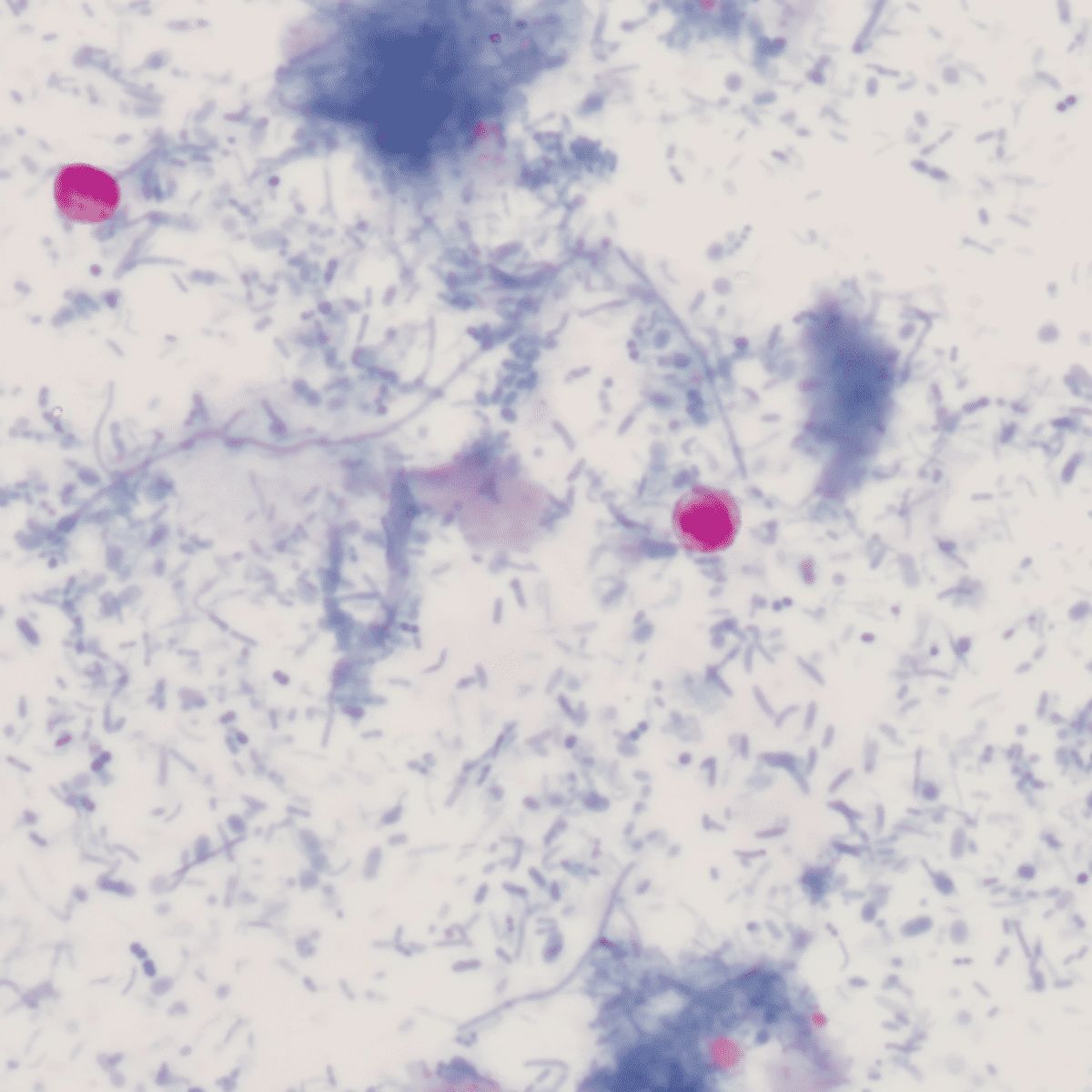 opleving Cryptosporidium