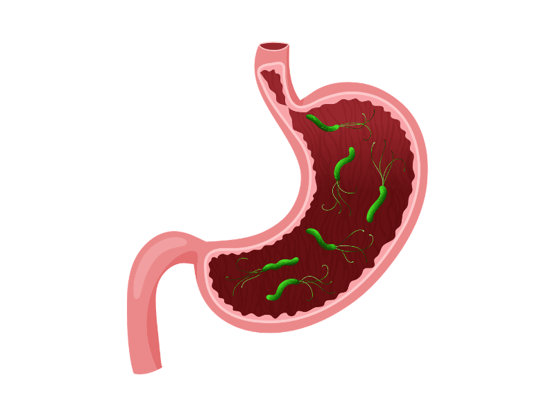 Helicobacter pylori
